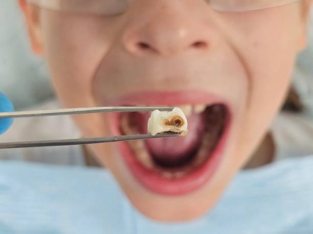 Best Emergency Denture Repair in Dewart, PA