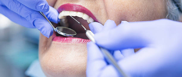 Best Emergency Dental Care for Broken or Chipped Teeth in Dewart, PA